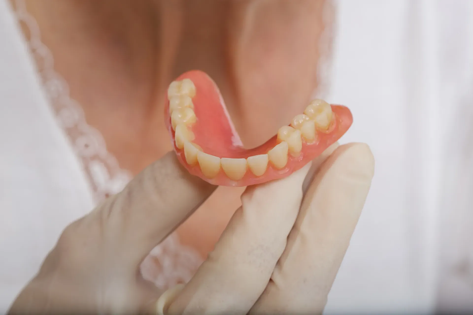 Partial Denture
