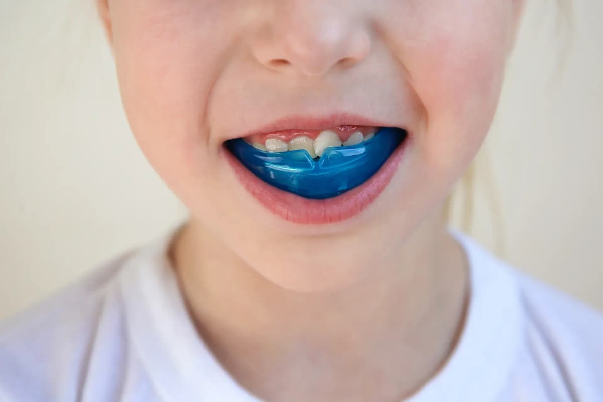 Mouth Guard