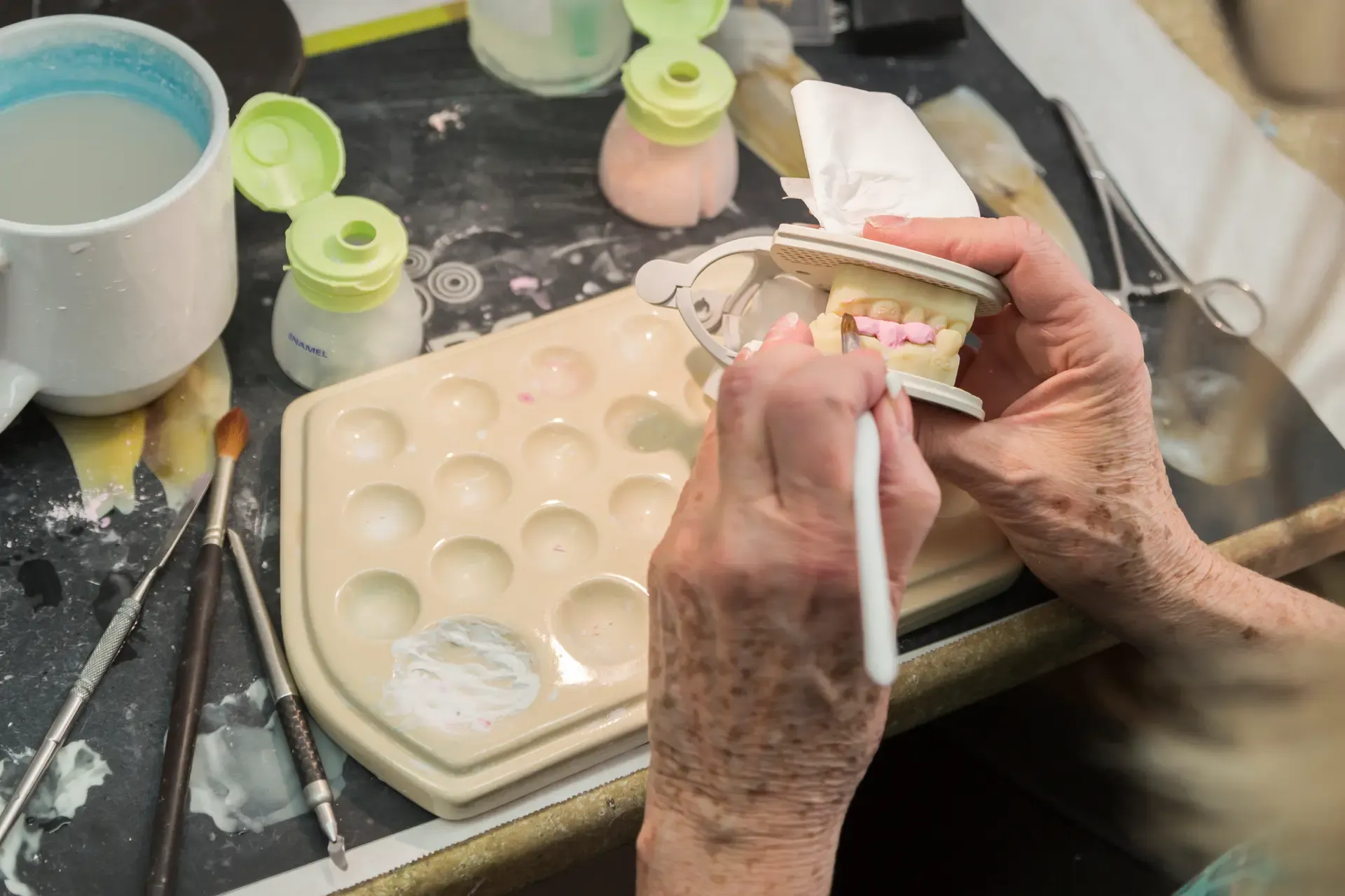 Partial Denture