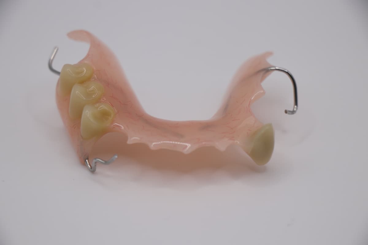 Acrylic Partial Denture